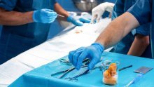 Urolog oštetio arteriju pacijenta, nije to primijetio: Čovjek preminuo