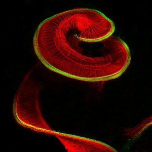 8. Pužnica novorođenčeta štakora (100x, stanice osjetnih dlačica (zeleno) i spiralni ganglij neurona (crveno))