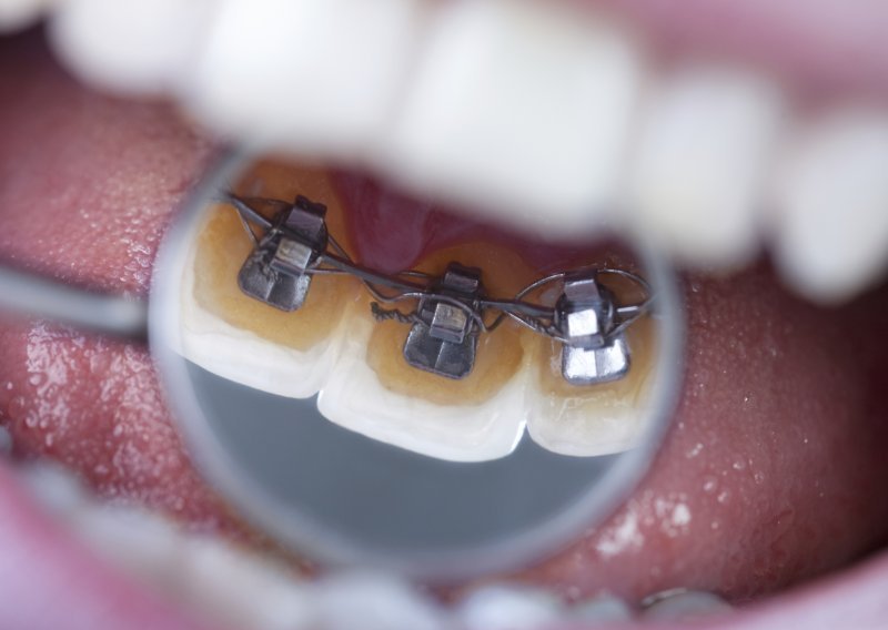 Ortodonti se nisu udruživali u kartel, AZTN je pogriješio