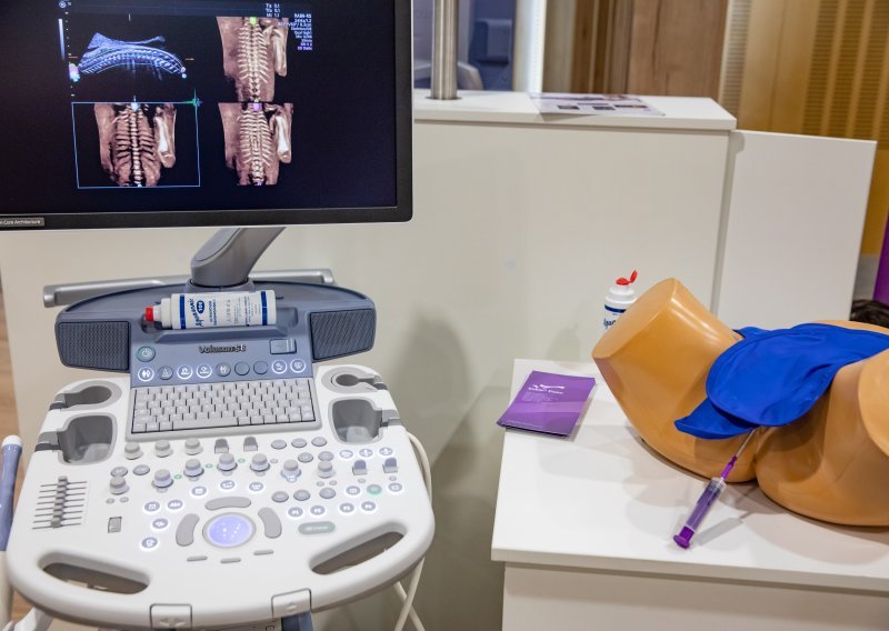Vinkovačka bolnica dobila tri nova ultrazvučna uređaja