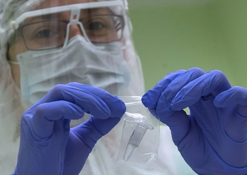 Španjolska nabavila neispravne testove za dijagnosticiranje koronavirusa