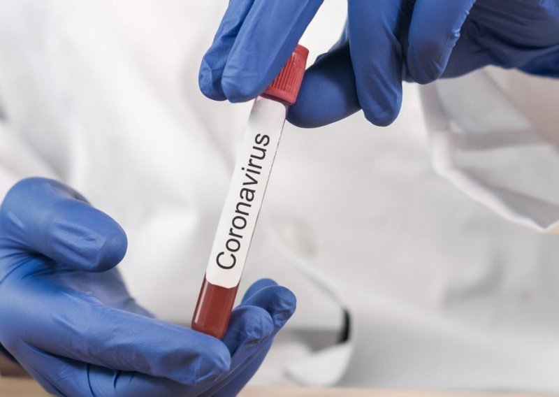 Znanstvenici sad znaju kako novi koronavirus zvuči i to im može pomoći u otkrivanju lijeka