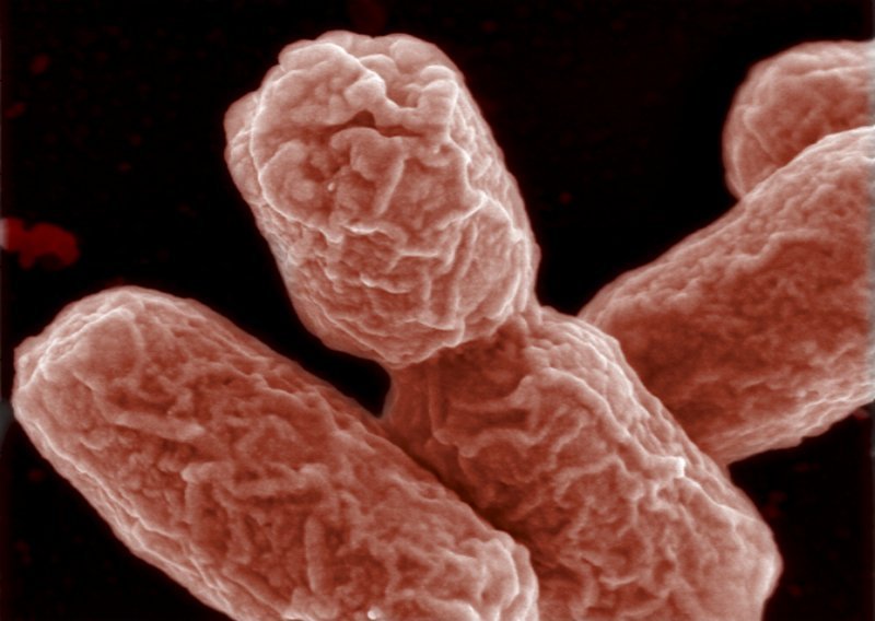 E. coli usmrtila dijete