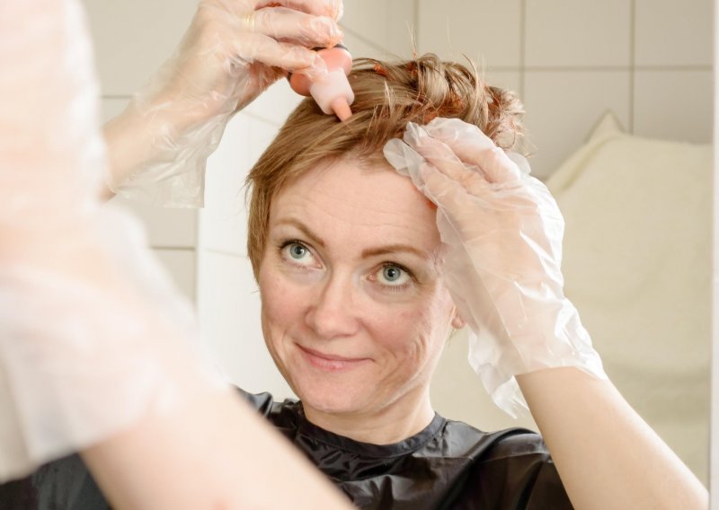 Obojali ste sami kosu kod kuće, ali ne znate kako se riješiti mrlja s kože? Evo nekoliko trikova za njihovo uklanjanje