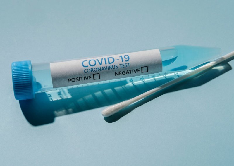 Sjedinjene Države odobrile prvi kućni test sline za covid-19