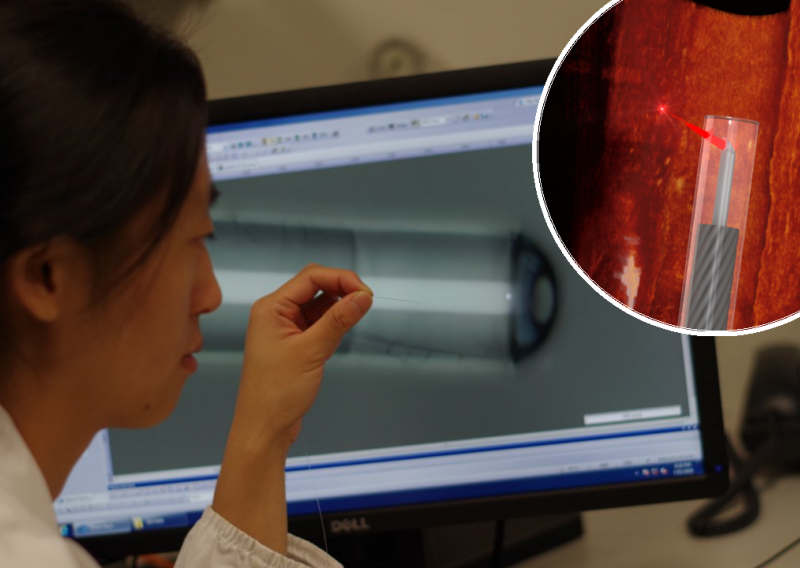 U 3D printeru otisnuli endoskop s lećom tankom poput ljudske dlake koji otkriva bolesti srca