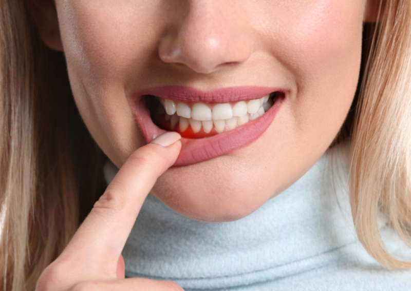 Parodontoza? U klinici Ortoimplant Dental SPA pomažu vam u njenom liječenju. Zatražite vaš besplatan prvi pregled i dijagnostiku!