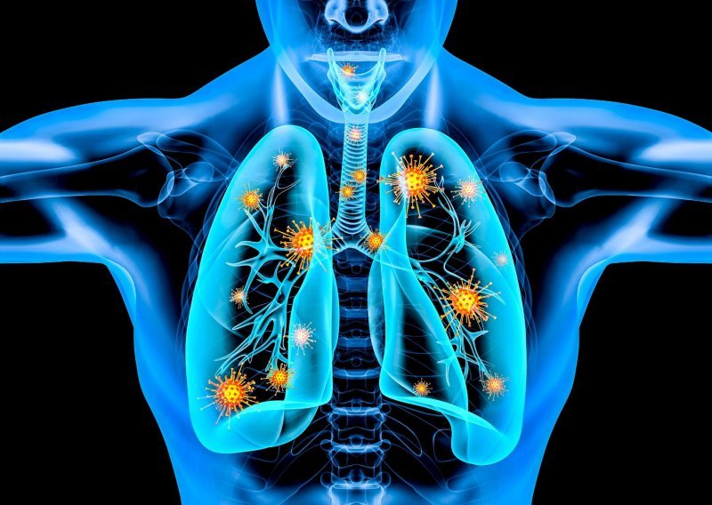 COVID-19 izaziva komplikacije na plućima, bubrezima i kardiovaskularne probleme, potvrdilo novo američko istraživanje