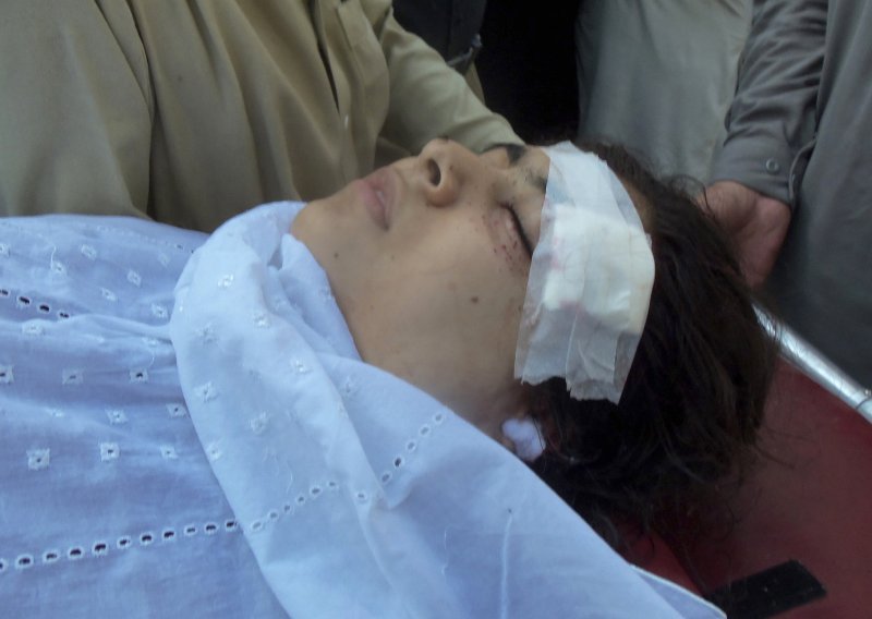 Pakistanka Malala ide na rekonstrukciju lubanje