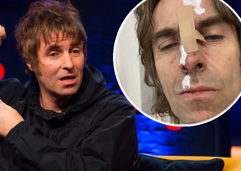 Liam Gallagher doživio nesreću: 'Sinoć sam ispao iz helikoptera, ne može sve ići glatko'