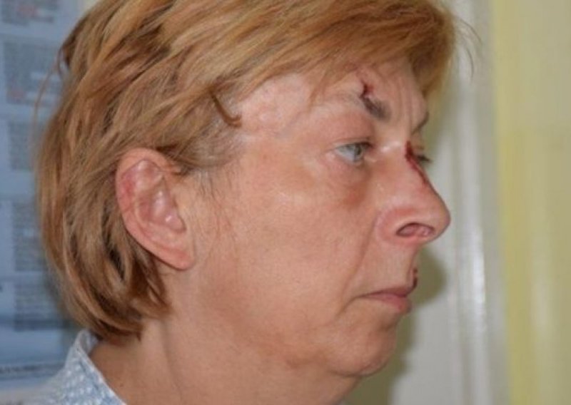 Slovakinja koja je ljetos pronađena pretučena na Krku sada tvrdi da je bila oteta