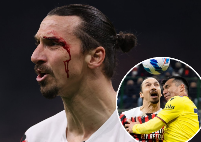 [FOTO] Težak sudar na San Siru; Zlatanu Ibrahimoviću razbijena arkada, a suparnik je prošao puno gore