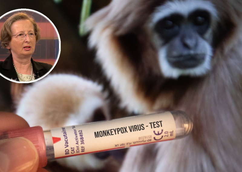 Alemka Markotić objavila detalje simptoma zaraze majmunskim boginjama, istaknula je da je smrtnost oko deset posto