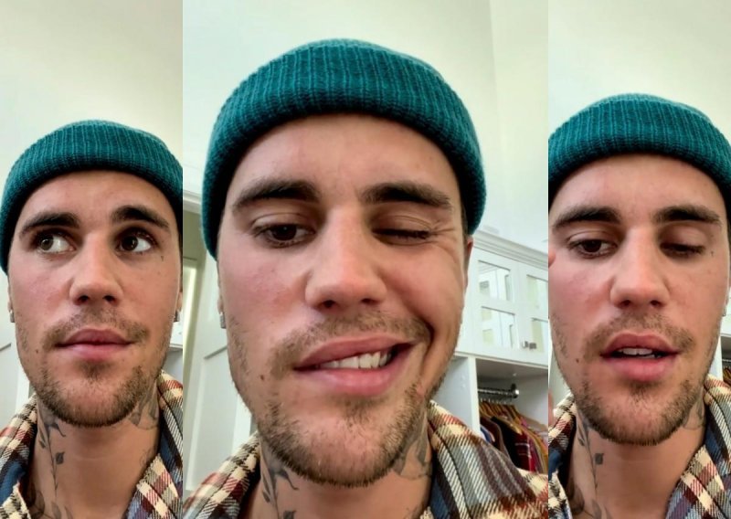 Justin Bieber otkrio da oporavlja od paralize lica, u video je pokazao o kakvom se stanju radi: 'Kao što vidite ne mogu trepnuti niti se nasmijati'