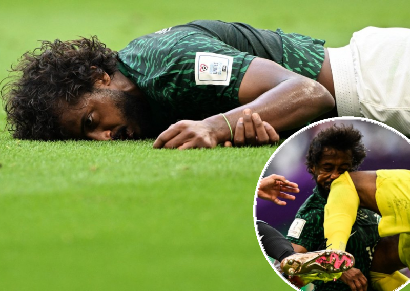 [FOTO] Stravična ozljeda zasjenila je senzacionalnu pobjedu Saudijske Arabije; dobio je koljenom u glavu i ostao nepomično ležati na terenu