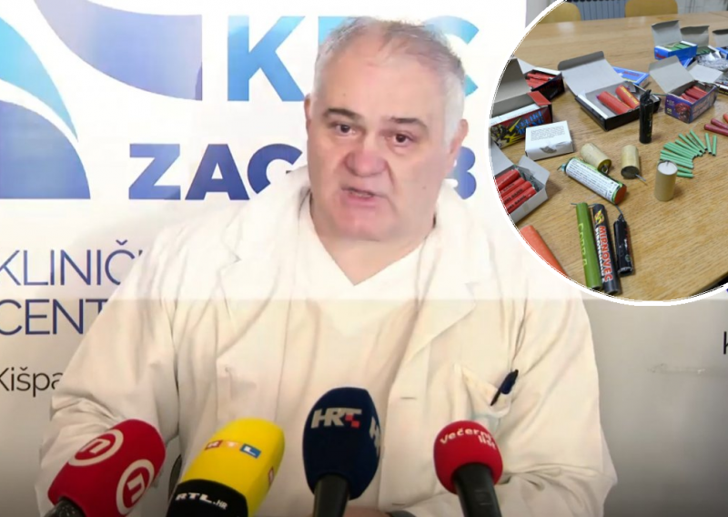 Liječnici KBC-a Zagreb nakon stradavanja djeteta od petarde: Napravili smo drugu operaciju, ostat će invalid