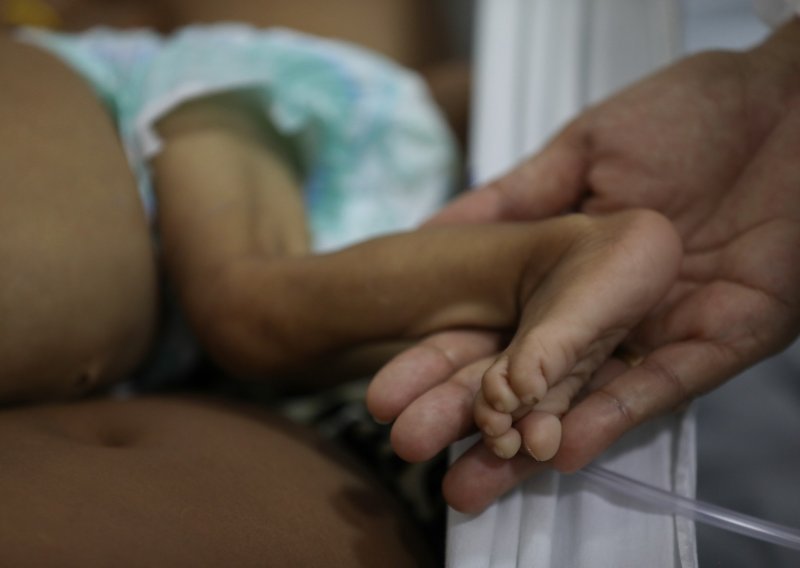 Više desetaka domorodačke djece u Brazilu završilo u bolnici zbog pothranjenosti
