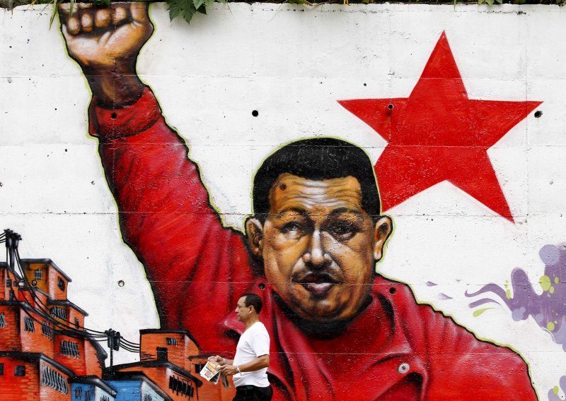 Chavez kreće u borbu protiv umjetnih sisa