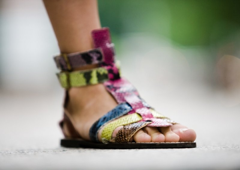 Sandale gladijatorice opasno je nositi svakodnevno