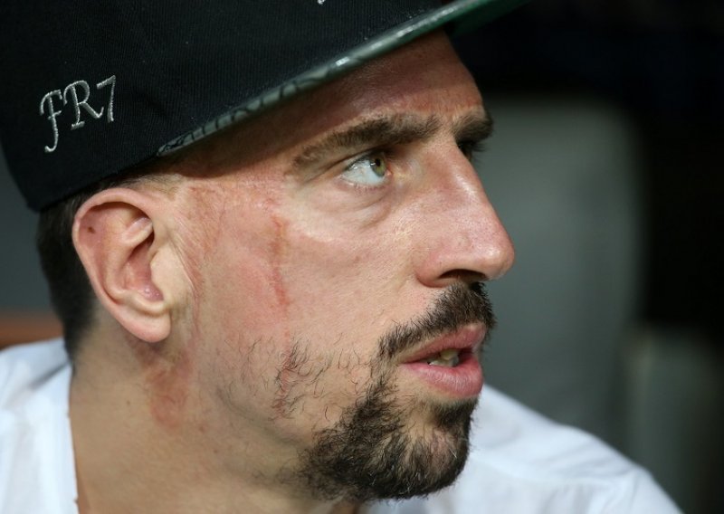 Franck Ribery opet u skandalu s prostitutkama