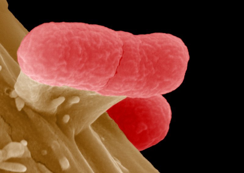 Crijevna bakterija dosad oduzela deset života