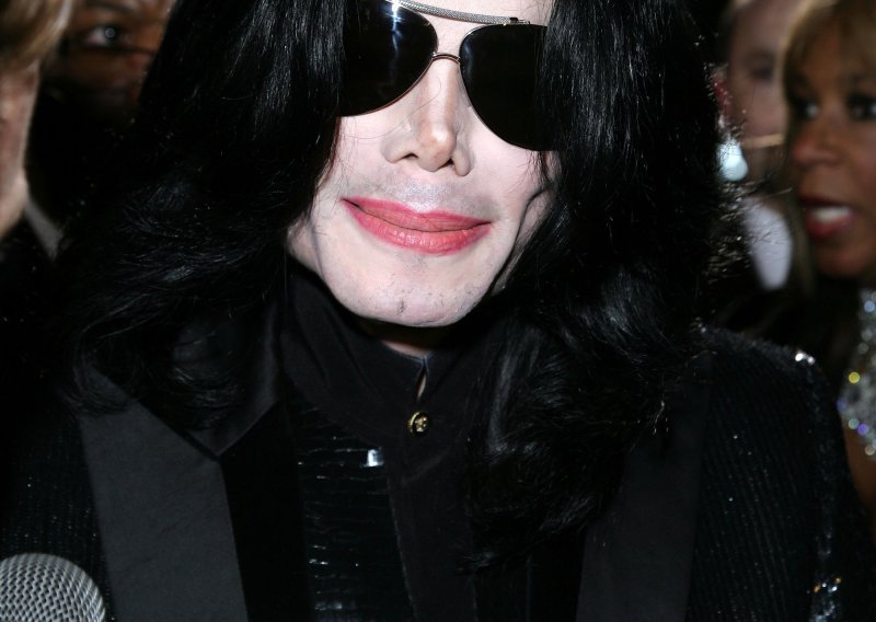 Michael Jackson ima rak kože