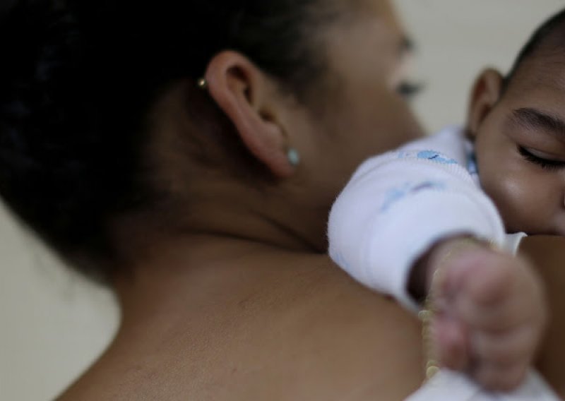 U Španjolskoj rođeno prvo dijete s mikrocefalijom