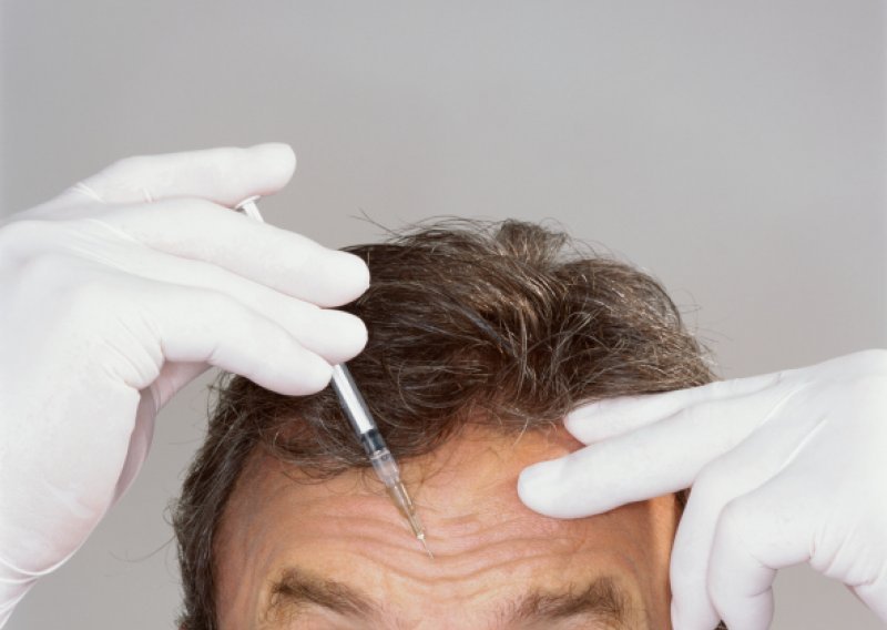 Botoks 'pegla' i teške glavobolje i migrene