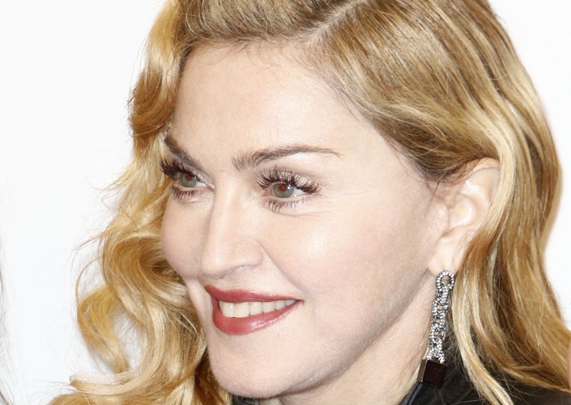 Je li i vama čudno Madonnino lice?