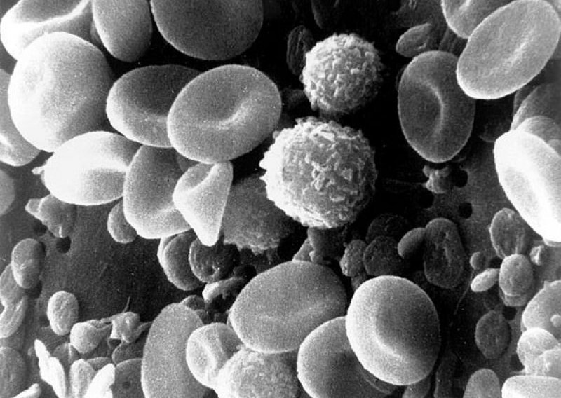 Širenje raka uspješno spriječeno nanočesticama!