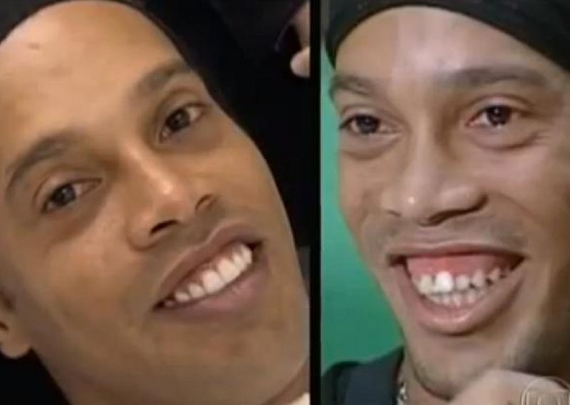 Ronaldinho nakon plastične operacije ljepši nego ikad!