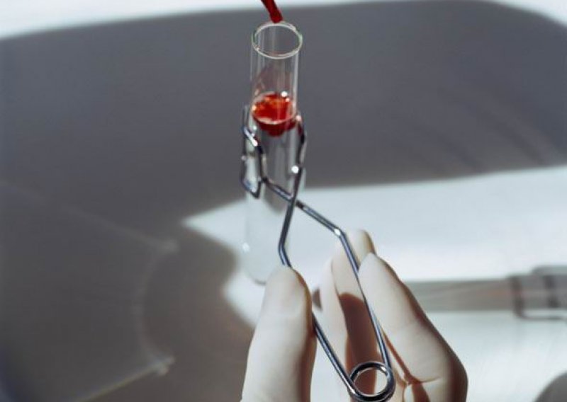 Znanstvenici planiraju proizvesti umjetnu krv iz matičnih stanica