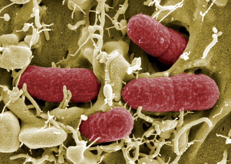 Zaraza E.coli zabilježena u 12 zemalja