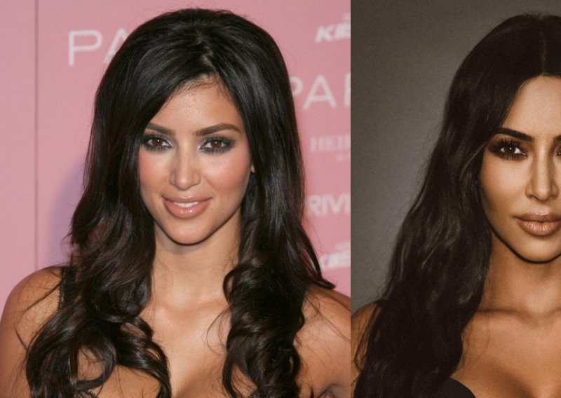 Kim Kardashian i dalje tvrdi da svoj nos nikada nije operirala, ali stare fotografije sve govore