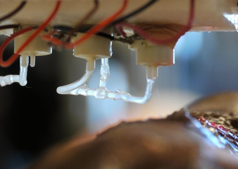 Kakvo dostignuće: Znanstvenici stvorili bioprinter koji ispisuje pacijentovu kožu direktno na otvorenu ranu