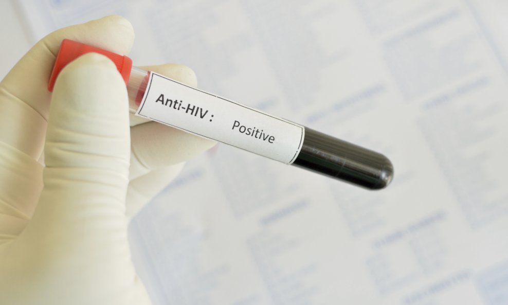 zdravlje HIV Aids