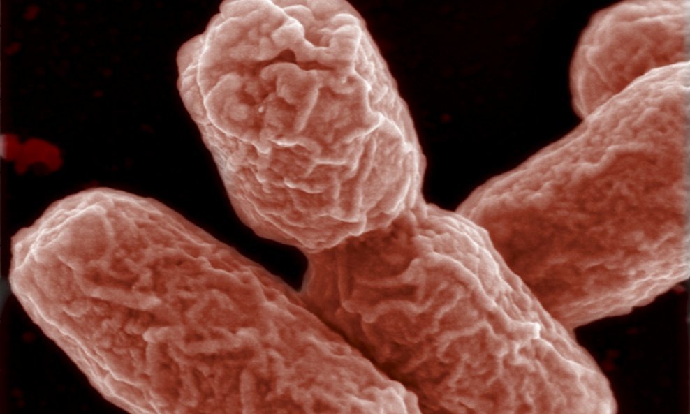 Smrtonosna bakterija Escherichia coli enterohemoragijskog soja (7)
