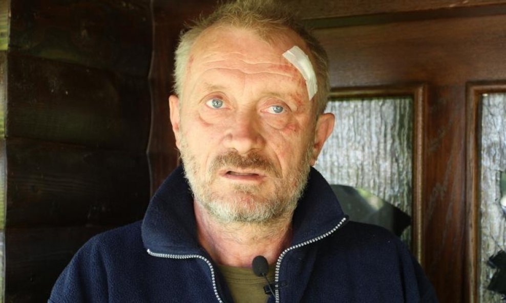 Slobodni novinar Zeljko Peratovic pretucen je u cetvrtak u kasnim poslijepodnevnim satima u svojoj kuci u Luki Pokupskoj. Nakon obrade u Opcoj bolnici Karlovac pusten je na kucnu njegu. Photo: /PIXSELL