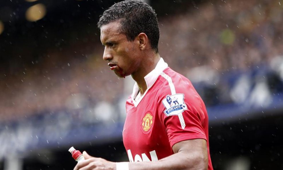 Nani (Manchester United)