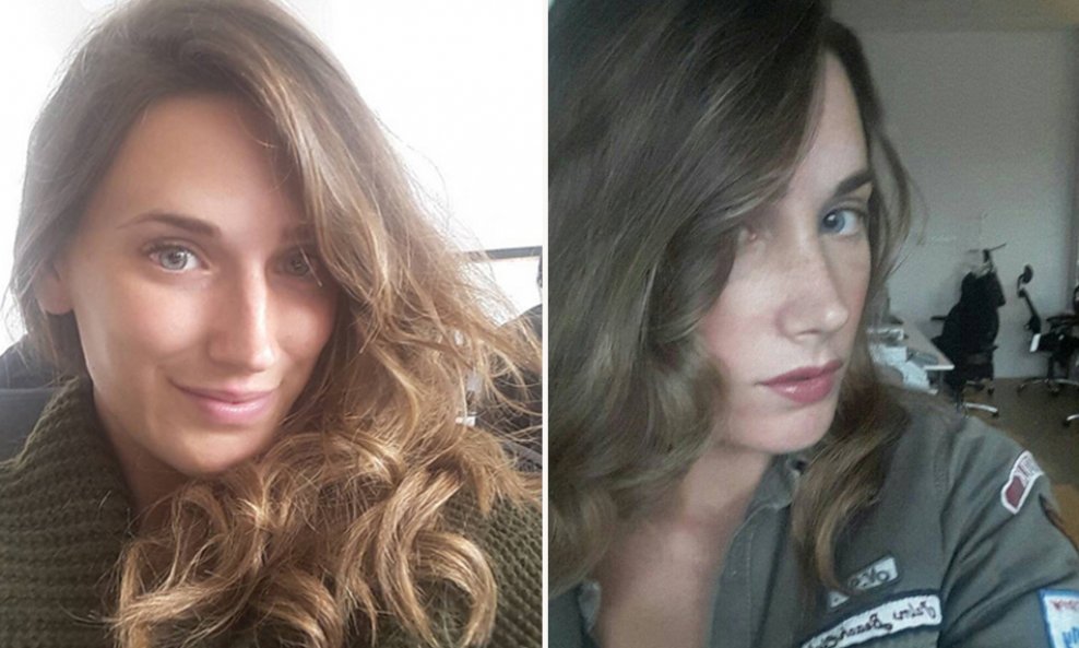 Ana Strizić prije i nakon estetske operacije