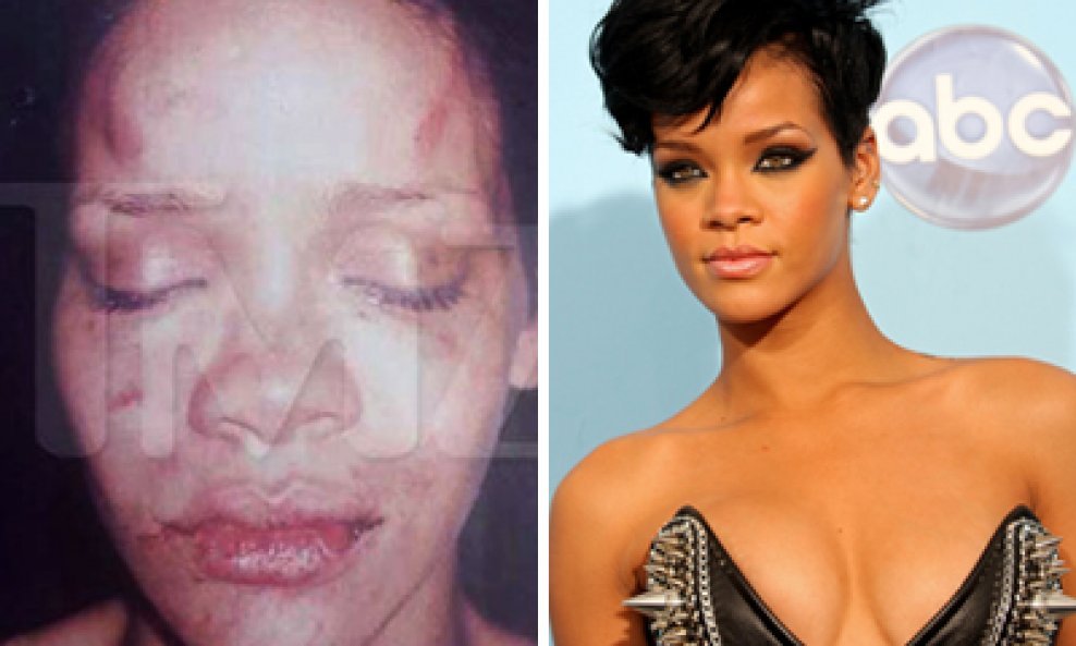 Rihanna_before_after