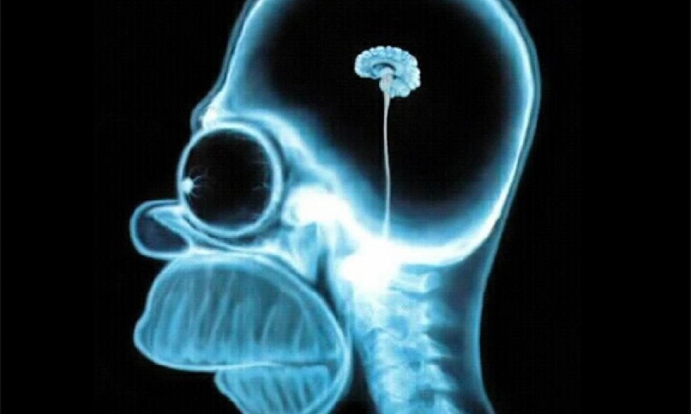 Homer Simpson mozak