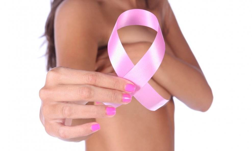 rak dojke