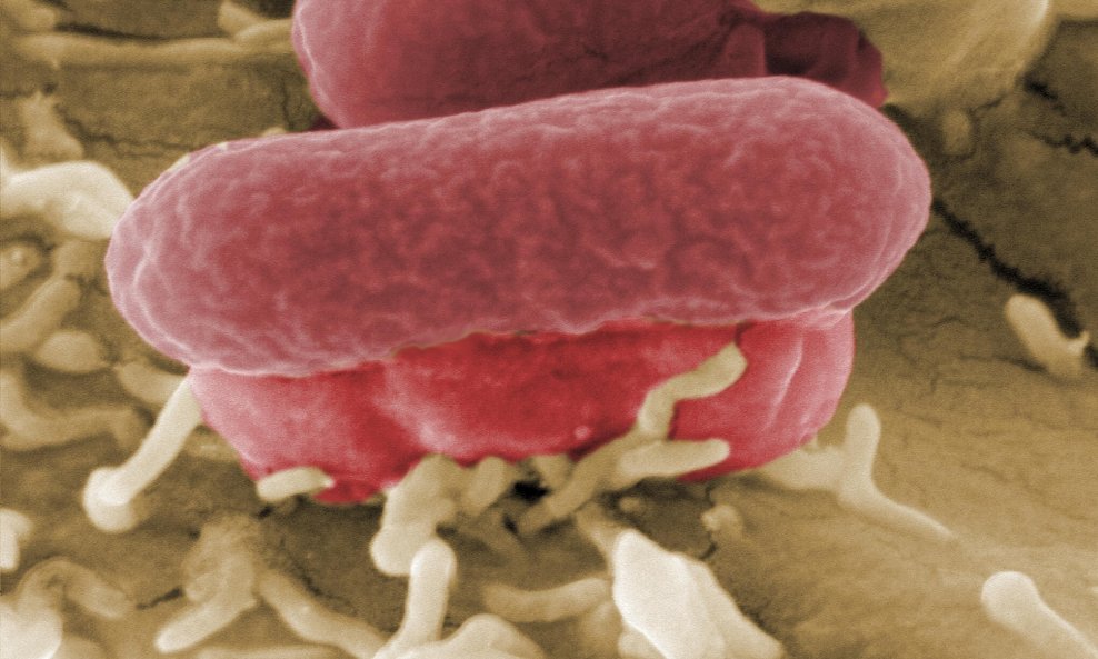 Smrtonosna bakterija Escherichia coli enterohemoragijskog soja (5)