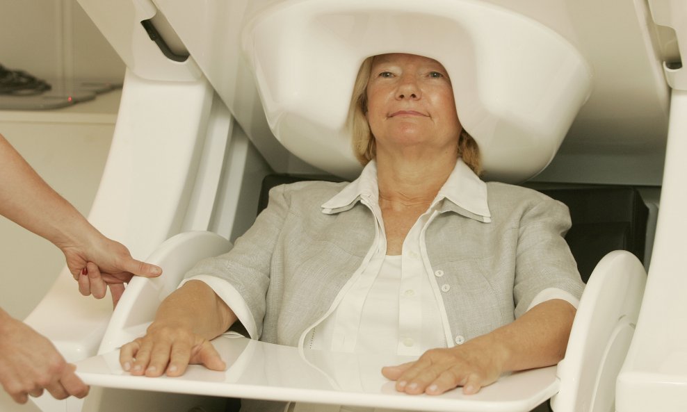 skeniranje mozak
