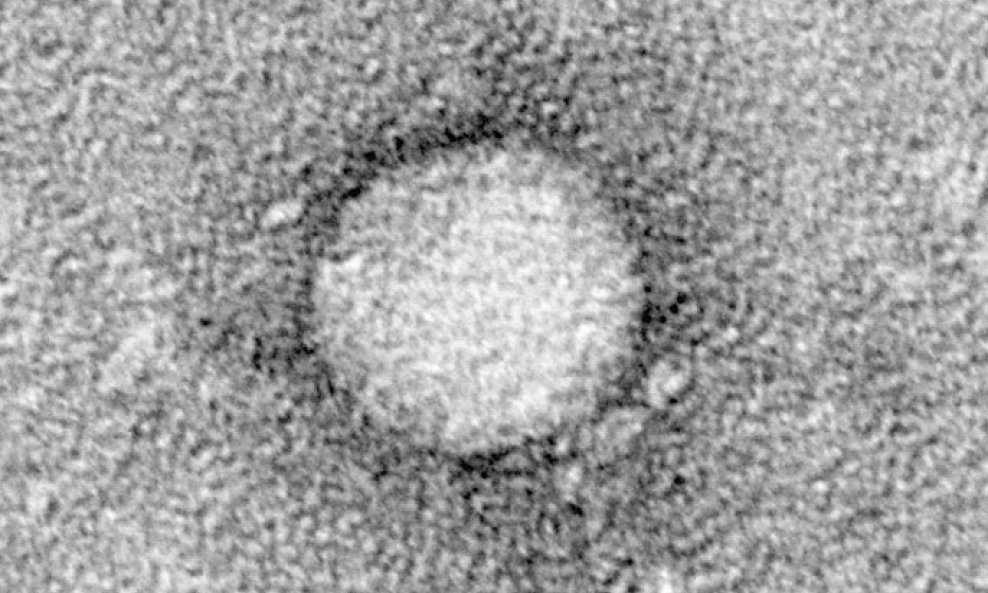 virus hepatitis C