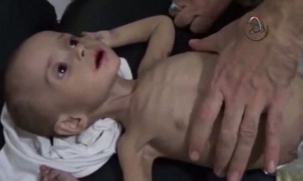 Pothranjena djeca Sirija