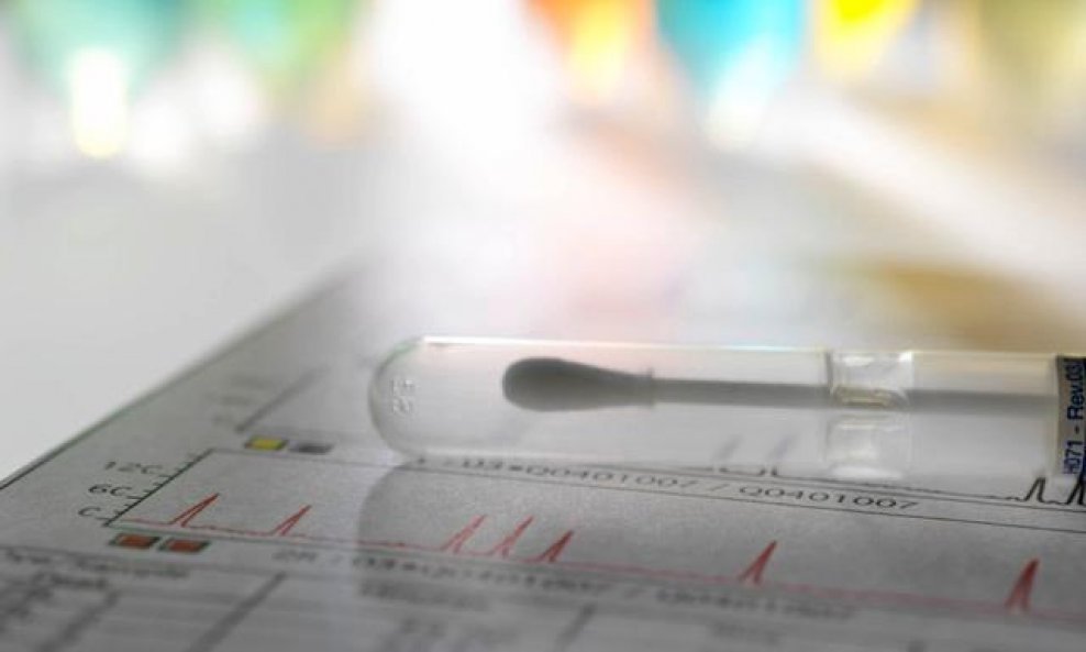 DNK test očinstva injekcija