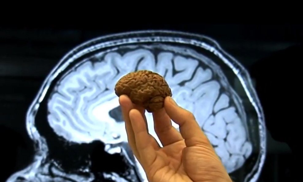 Je li veličina doista važna kod mozga, zanimalo je znanstvenike