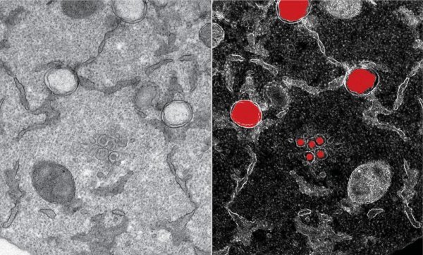 Dio zaražene stanice promatra se transmisijskom elektronskom mikroskopijom, u kojoj se strukture specifične za SARS-CoV-2 (u crvenoj boji, sa zrcalne slike s desne strane) mogu otkriti već šest sati nakon infekcije